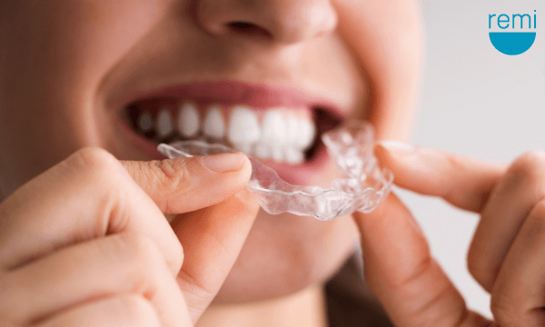 Keep Your Teeth Grinding Night Guard Fresh with Easy Cleaning Methods
