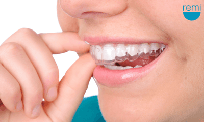 5 Tips for Getting Used to Wearing a Mouth Guard for Teeth Grinding