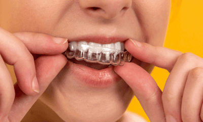 10 Benefits of Using a Teeth Grinding Mouth Guard