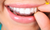 Lost Your Retainer After SmileDirectClub Shut Down? ShopRemi Offers Replacement Relief