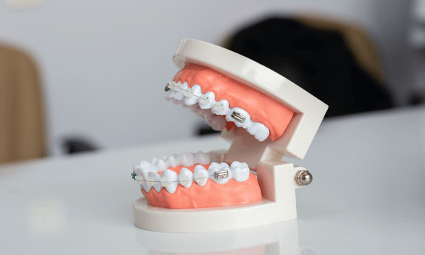 Lockjaw Syndrome: How To Recognize the Symptoms and Seek Treatment