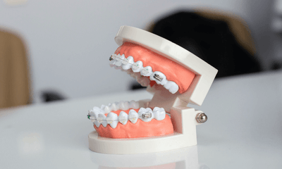 Lockjaw Syndrome: How To Recognize the Symptoms and Seek Treatment