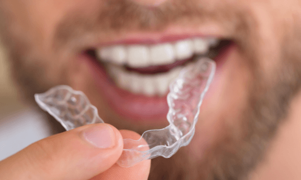 Does Dental Insurance Or FSA/HSA Cover mouth Guards?