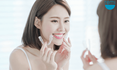 Unlock Your Best Smile Yet: The Ultimate Guide to Teeth Whiteners