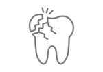 Cracked / Worn Teeth